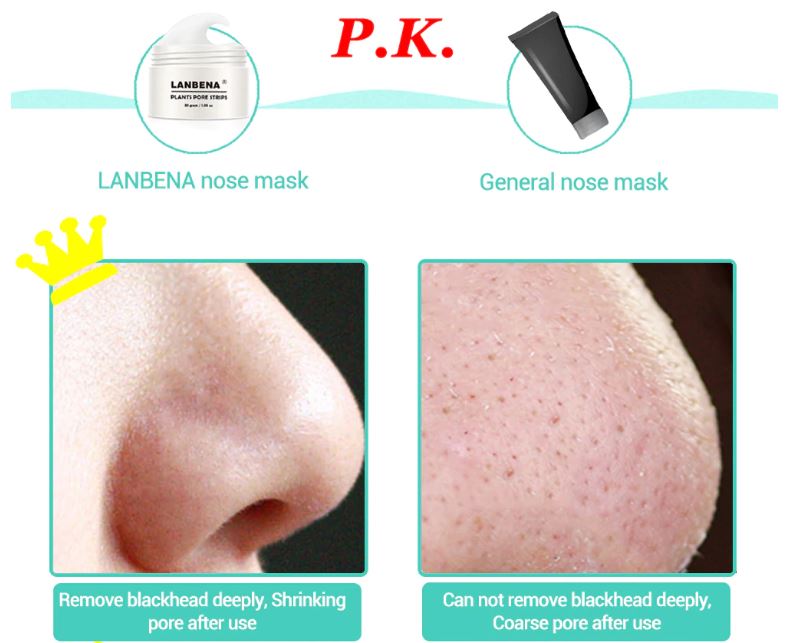 LANBENA Masker  Pencabut Komedo Blackhead Acne Remover 